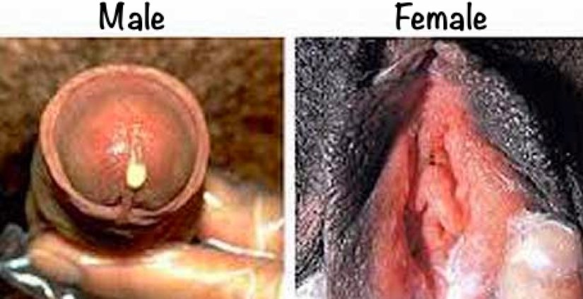 Gonorrhea health awareness illustration